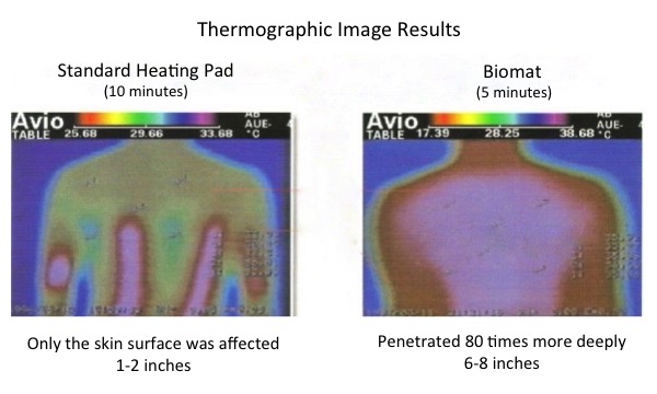 Thermographic Image